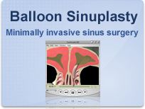 Sinuplasty- get relief from chronic sinutitis- Atlanta GA